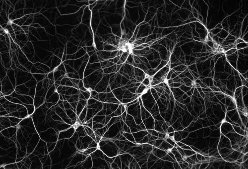 Rede Neuronal